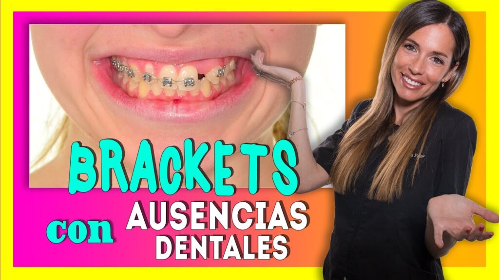 ortodoncia con dientes faltantes