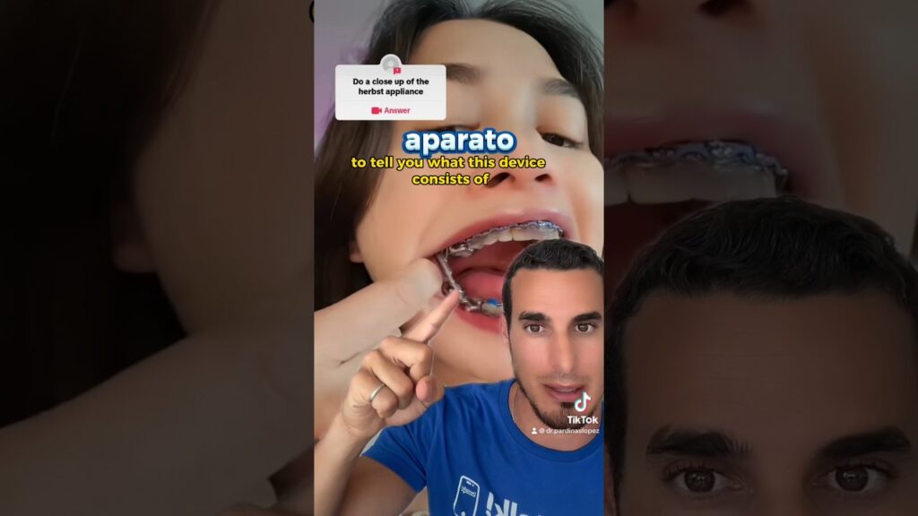 ortodoncia con gomas para mandibulas salidas