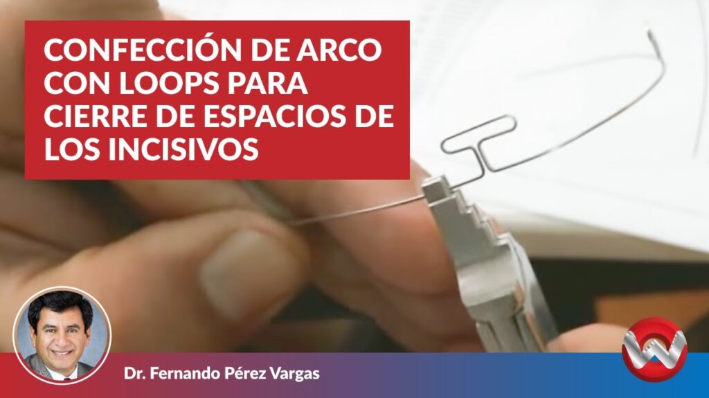 ortodoncia confeccion arcos de cierre fernando perez bargas