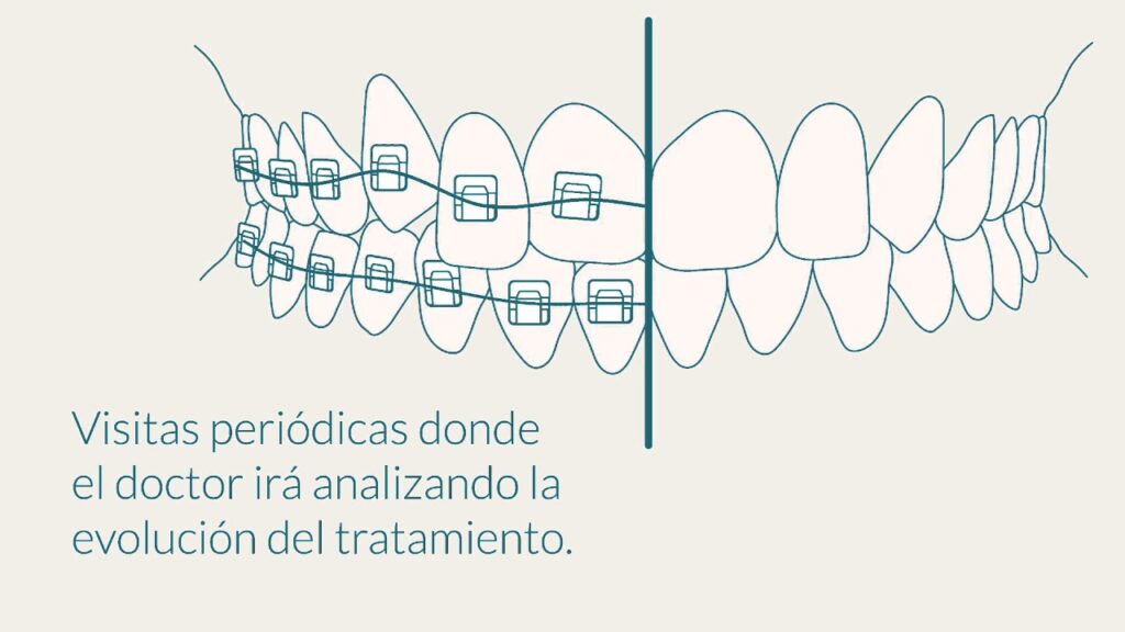 ortodoncia damon alcala de guadaira