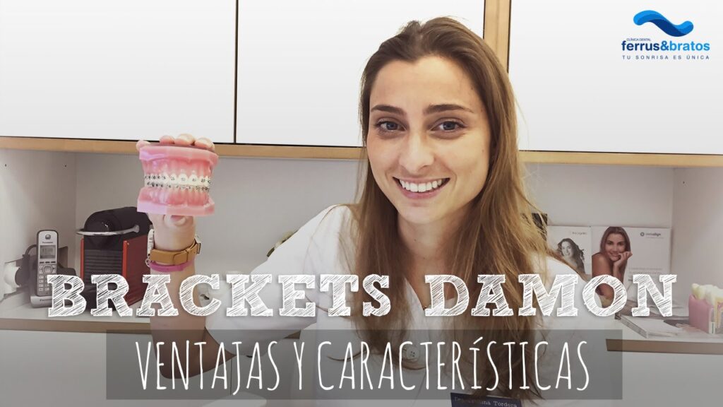 ortodoncia damon argentina