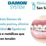 ortodoncia damon vigo