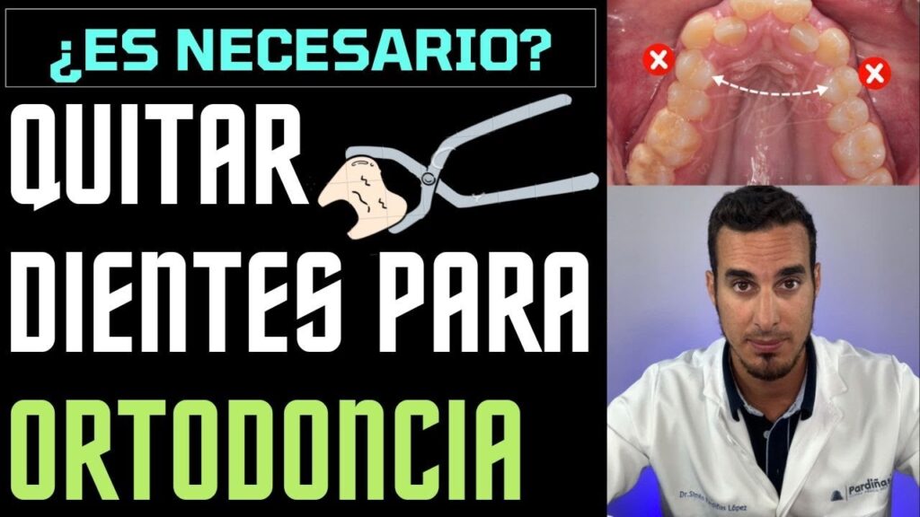 ortodoncia desnivel de altura entre los premolare-molares y caninos-incisivos