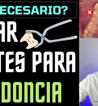 ortodoncia desnivel de altura entre los premolare-molares y caninos-incisivos