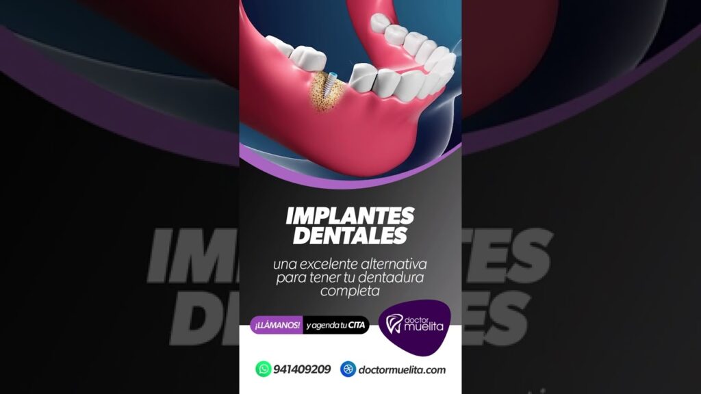 ortodoncia e implantes dentales: cabero & lópez clínica dental