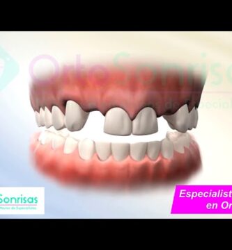 ortodoncia e implantes.com