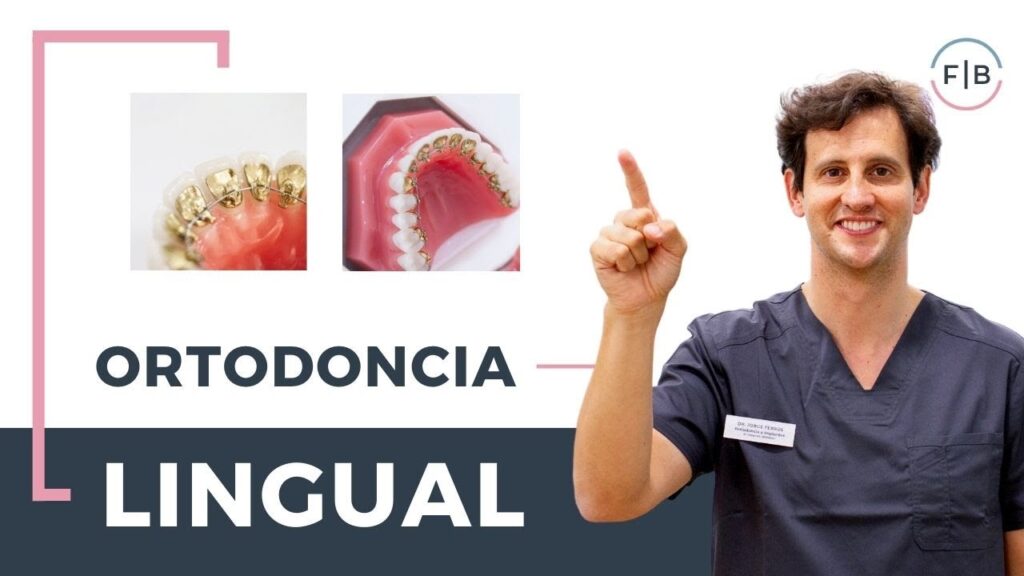 ortodoncia intralingual