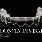 ortodoncia invisalign precio