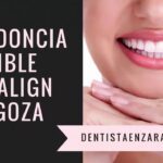 ortodoncia invisalign zaragoza