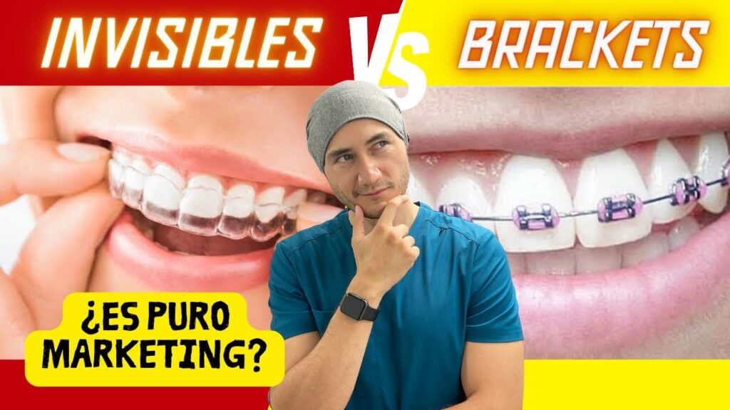 ortodoncia invisible invisalign opiniones