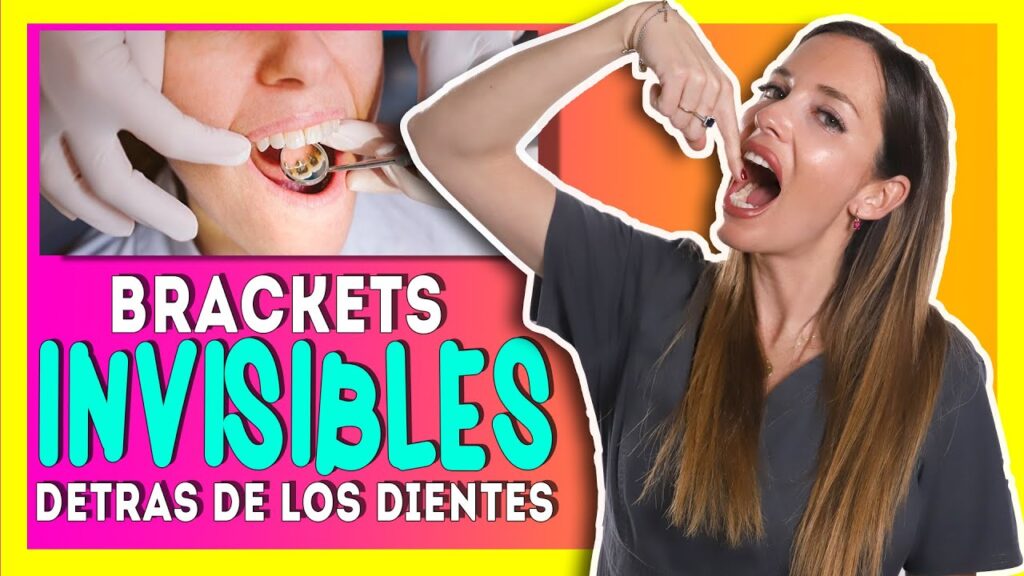 ortodoncia por dentro de los dientes