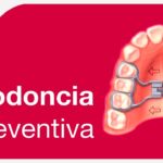 ortodoncia preventiva