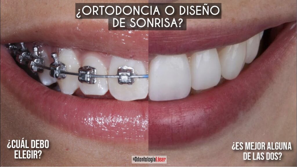 ortodoncia sonrisa