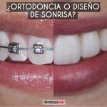 ortodoncia sonrisa