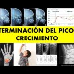 picos de crecimiento ortodoncia