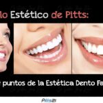 pitts ortodoncia