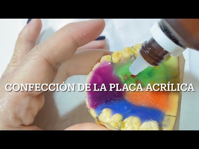 placa acrilica ortodoncia