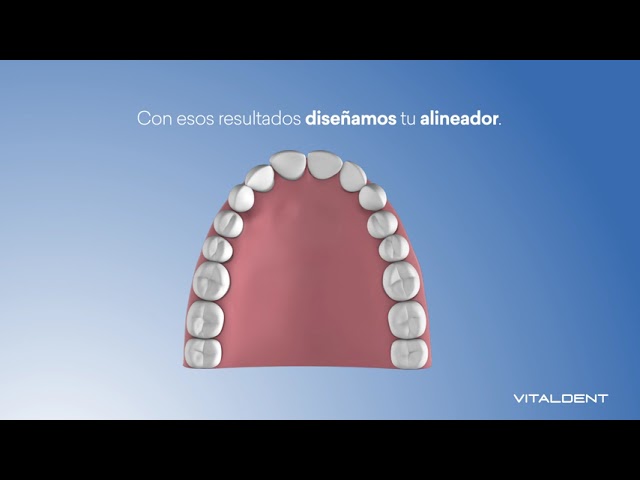 precio ortodoncia invisible vitaldent