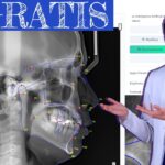 programa de ortodoncia gratis