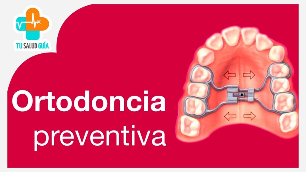 que es la ortodoncia preventiva