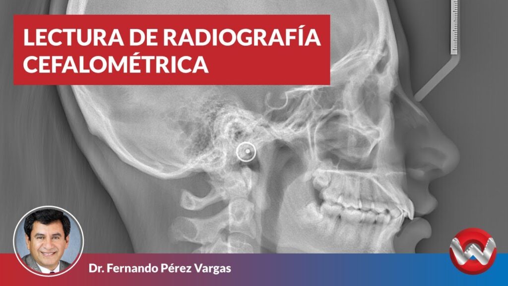 radiografia lateral de craneo ortodoncia