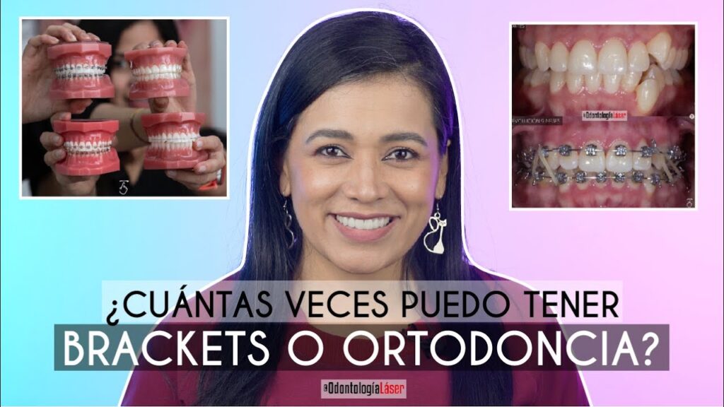 se puede usar ortodoncia dos veces