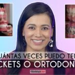 se puede usar ortodoncia dos veces