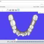 simulador de ortodoncia