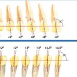 tecnica mbt ortodoncia