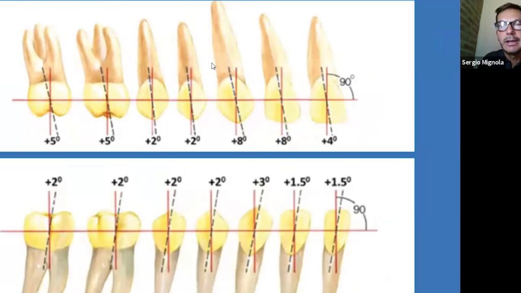 tecnica mbt ortodoncia pdf