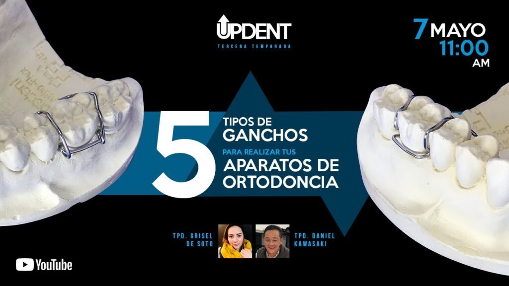 tipos de ganchos de ortodoncia