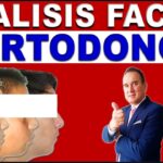 tipos de perfil facial en ortodoncia