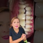 tratamiento de ortodoncia en pacientes con periodontitis agresiva