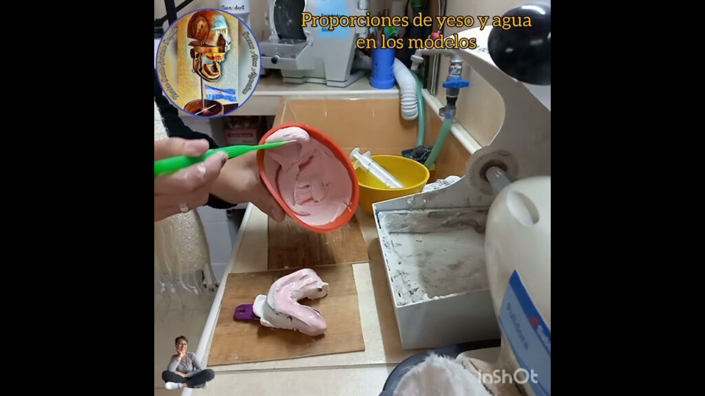 yeso de ortodoncia